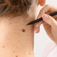 Clinical Dermatology | Body Concepts Dermatology and Medical Clinic | Dr. Pag-asa Bernardo-Bagolor | San Rafael, Bulacan Clinical Dermatology | Body Concepts Dermatology and Medical Clinic | Dr. Pag-asa Bernardo-Bagolor | San Rafael, Bulacan